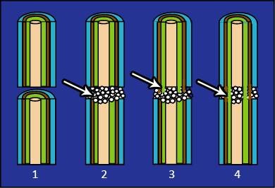 Figure2. Mechanism of graft formation